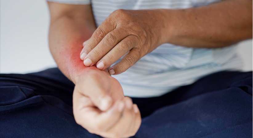 I Just Need to Sleep! Improving Itch in Patients With CKD-aP