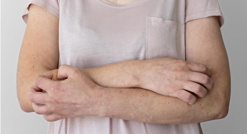 Improving Chronic Kidney Disease-associated Pruritus (CKD-aP) patients’ quality of life